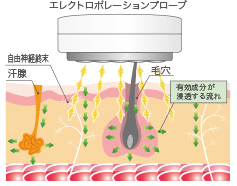 エレクトロポレーション導入イメージ